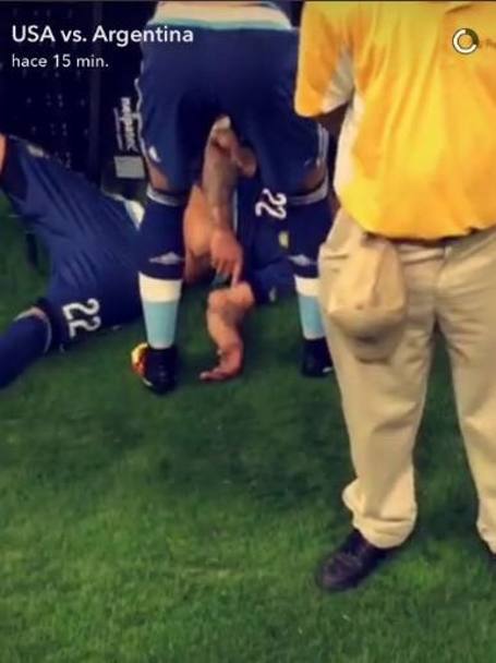 Finisce in semifinale l&#39;avventura di Lavezzi in Coppa America: il Pocho, durante la sfida contro gli Stati Uniti, si  fratturato il braccio sinistro dopo aver impattato contro i cartelloni pubblicitari.